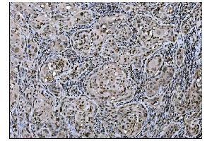 IHC analysis of Fos B/FOSB using anti-Fos B/FOSB antibody (ABIN7599279).
