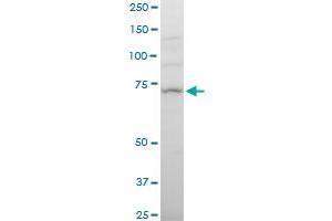 NCSTN polyclonal antibody (A01), Lot # 051214JC01. (Nicastrin antibody  (AA 16-115))