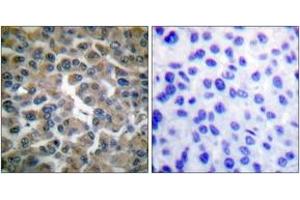 Immunohistochemistry (IHC) image for anti-Nuclear Factor of kappa Light Polypeptide Gene Enhancer in B-Cells Inhibitor, epsilon (NFKBIE) (AA 131-180) antibody (ABIN2888569) (NFKBIE antibody  (AA 131-180))