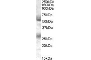 Western Blotting (WB) image for anti-Feline Leukemia Virus Subgroup C Cellular Receptor 1 (FLVCR1) (C-Term) antibody (ABIN2465703) (FLVCR antibody  (C-Term))