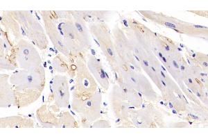 Detection of MAPK6 in Human Cardiac Muscle Tissue using Polyclonal Antibody to Mitogen Activated Protein Kinase 6 (MAPK6) (MAPK6 antibody  (AA 1-316))
