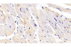 Detection of MAPK6 in Human Cardiac Muscle Tissue using Polyclonal Antibody to Mitogen Activated Protein Kinase 6 (MAPK6)