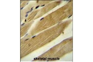 RPH3AL Antibody (C-term) (ABIN654698 and ABIN2844391) immunohistochemistry analysis in formalin fixed and paraffin embedded human skeletal muscle followed by peroxidase conjugation of the secondary antibody and DAB staining. (RPH3AL antibody  (C-Term))