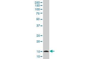 TOMM20 polyclonal antibody (A01), Lot # 051129JC01 Western Blot analysis of TOMM20 expression in A-431 . (TOMM20 antibody  (AA 1-145))