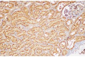 Immunohistochemistry of paraffin-embedded Rat kidney using FGB Polycloanl Antibody at dilution of 1:200 (Fibrinogen beta Chain antibody)
