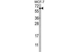 Western blot analysis of AKT1 Antibody (N-term) in MCF-7 cell line lysates (35ug/lane). (AKT1 antibody  (N-Term))