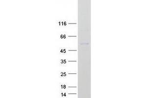 T-Box 19 Protein (TBX19) (Myc-DYKDDDDK Tag)