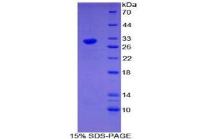 SDS-PAGE analysis of Mouse EGR4 Protein.