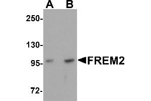 Western Blotting (WB) image for anti-Fras1 Related Extracellular Matrix Protein 2 (FREM2) (Middle Region) antibody (ABIN1030933) (FREM2 antibody  (Middle Region))