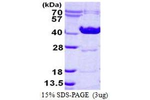 Image no. 1 for Ornithine Carbamoyltransferase (OTC) protein (His tag) (ABIN7279762) (OTC Protein (His tag))