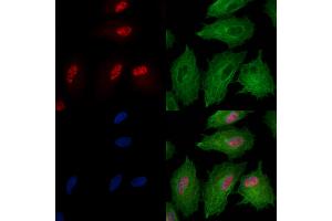 Phospho-SIRT6 (Ser10) Antibody staining A549 cells(heat shock treatment) by IF/ICC.
