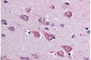 Human Brain, Cortex (formalin-fixed, paraffin-embedded) stained with SOCS1 antibody ABIN343903 at 5 ug/ml followed by biotinylated goat anti-rabbit IgG secondary antibody ABIN481713, alkaline phosphatase-streptavidin and chromogen. (SOCS1 antibody  (C-Term))