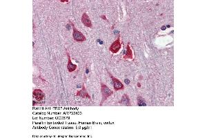 Immunohistochemistry with Human Brain, cortex tissue at an antibody concentration of 5. (T-Box 5 antibody  (N-Term))