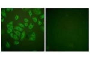 Immunofluorescence analysis of A549 cells, using Stefin A antibody. (CSTA antibody  (C-Term))