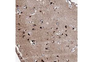 Immunohistochemical staining of human cerebral cortex with CKAP5 polyclonal antibody  shows strong cytoplasmic positivity in neuronal cells.