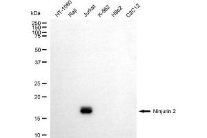 Western blotting analysis using ninjurin 2 antibody (ABIN7799604).