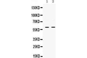 Western blot analysis of SKAP55 expression in PANC whole cell lysates (lane 1) and JURKAT whole cell lysates (lane 2).