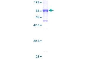 Image no. 1 for Glycerol Kinase 2 (GK2) (AA 1-553) protein (GST tag) (ABIN1355159) (GK2 Protein (AA 1-553) (GST tag))