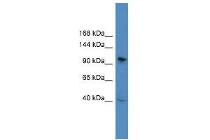 WB Suggested Anti-BCL11B Antibody Titration: 0. (BCL11B antibody  (C-Term))