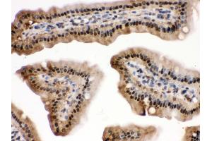 Immunohistochemistry (Paraffin-embedded Sections) (IHC (p)) image for anti-Mitogen-Activated Protein Kinase 13 (MAPK13) (AA 332-365), (C-Term) antibody (ABIN3043610)