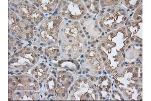 Immunohistochemical staining of paraffin-embedded Human prostate tissue using anti-BSG mouse monoclonal antibody. (CD147 antibody)