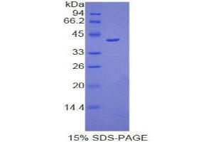 SDS-PAGE (SDS) image for Osteocalcin (BGLAP) (AA 14-95) protein (His tag,GST tag) (ABIN2123428)