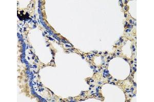 Immunohistochemistry of paraffin-embedded Rat lung using IL36G Polyclonal Antibody at dilution of 1:100 (40x lens). (IL1F9 antibody)