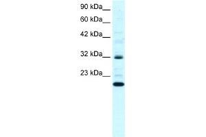 WB Suggested Anti-ARHGDIG Antibody Titration:  0. (ARHGDIG antibody  (N-Term))