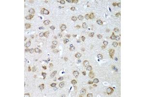 Immunohistochemistry (Paraffin-embedded Sections) (IHC (p)) image for anti-Eukaryotic Translation Initiation Factor 1A, X-Linked (EIF1AX) (AA 10-144) antibody (ABIN6140017)