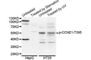 Western Blotting (WB) image for anti-Cyclin E1 (CCNE1) (pThr395) antibody (ABIN3019435) (Cyclin E1 antibody  (pThr395))