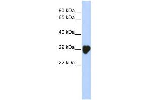WB Suggested Anti-CA1 Antibody Titration: 0. (CA1 antibody  (N-Term))