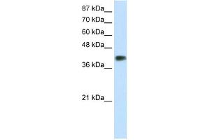 WB Suggested Anti-DLX3 Antibody Titration:  1. (DLX3 antibody  (C-Term))