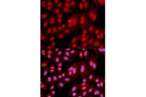 Immunofluorescence analysis of U2OS cell using PPP2R2A antibody. (PPP2R2A antibody)