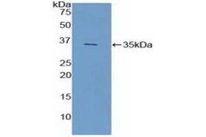 Western blot analysis of recombinant Mouse FCN1. (FCN1 antibody  (AA 25-317))