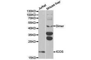 Western Blotting (WB) image for anti-Inducible T-Cell Co-Stimulator (ICOS) antibody (ABIN1873127) (ICOS antibody)
