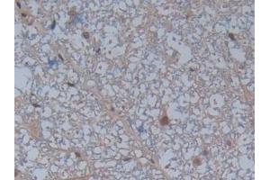 Immunohistochemistry (IHC) image for anti-Coagulation Factor XIII, A1 Polypeptide (F13A1) (AA 140-377) antibody (ABIN7440509)