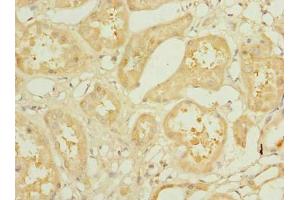 Immunohistochemistry of paraffin-embedded human kidney tissue using ABIN7157306 at dilution of 1:100 (KLHDC5 antibody  (AA 1-410))