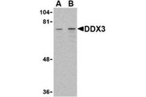 Western blot analysis of DDX3 in HepG2 cell lysate with AP30283PU-N DDX3 antibody at (A) 1 and (B) 2 μg/ml. (DDX3X antibody  (Intermediate Domain))