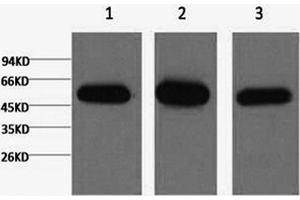 Western Blotting (WB) image for anti-Tubulin, beta 1 (TUBB1) antibody (ABIN5956137) (TUBB1 antibody)