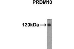 Western Blotting (WB) image for anti-PR Domain Containing 10 (PRDM10) (N-Term) antibody (ABIN356377) (PRDM10 antibody  (N-Term))