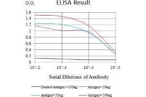 Black line: Control Antigen (100 ng),Purple line: Antigen (10 ng), Blue line: Antigen (50 ng), Red line:Antigen (100 ng) (FcRn antibody  (AA 24-297))