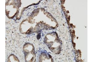 Immunostaining (ISt) image for anti-ATP-Binding Cassette, Sub-Family F (GCN20), Member 2 (ABCF2) (AA 1-110) antibody (ABIN564348)