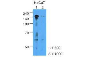 The extracts of HaCaT (35 ug) were resolved by SDS-PAGE, transferred to PVDF membrane and probed with anti-human EGFR (1:500 or 1000). (EGFR antibody  (AA 424-605))