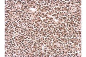 IHC-P Image PFKFB3 antibody [C3], C-term detects PFKFB3 protein at nucleus on BT483 xenograft by immunohistochemical analysis. (PFKFB3 antibody  (C-Term))