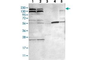 Western blot analysis of Lane 1: RT-4, Lane 2: U-251 MG, Lane 3: Human Plasma, Lane 4: Liver, Lane 5: Tonsil with PARP14 polyclonal antibody  at 1:250-1:500 dilution. (PARP14 antibody)