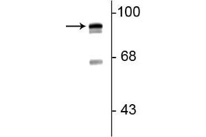 Western blot of rat lung lysate showing specific immunolabeling of the ~93 kDa periostin protein doublet. (Periostin antibody  (C-Term))