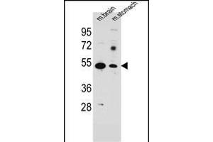 Western Blotting (WB) image for anti-Solute Carrier Family 16, Member 11 (Monocarboxylic Acid Transporter 11) (SLC16A11) (AA 48-76), (N-Term) antibody (ABIN654868)