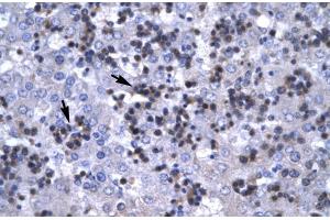 Human Liver; RBPSUH antibody - C-terminal region in Human Liver cells using Immunohistochemistry (RBPJ antibody  (C-Term))