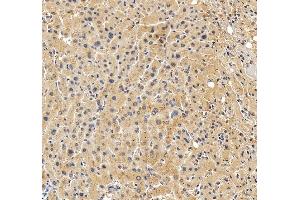 IHC analysis of ABCB4 using anti-ABCB4 antibody (ABIN3043734). (ABCB4 antibody  (AA 601-720))