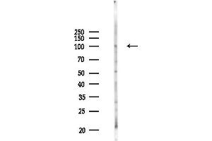 anti-Signal Peptide, CUB Domain, EGF-Like 1 (SCUBE1) antibody